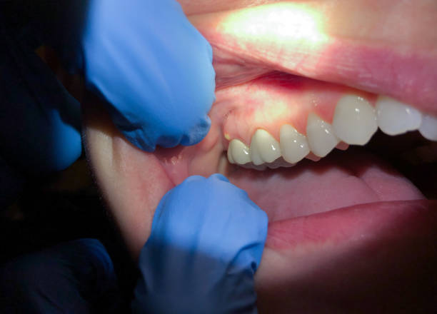 Best Tooth Infection Emergency Dentist  in Arbury Hls, IL